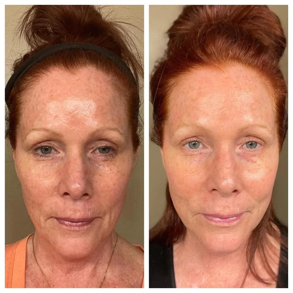 Beauty Focus Collagen+