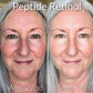 ageLoc Tru Face Peptide Retinol Complex - NOW AVAILABLE