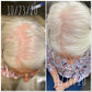 Ultimate Hair Care Trifecta -- Scalp & Hair System