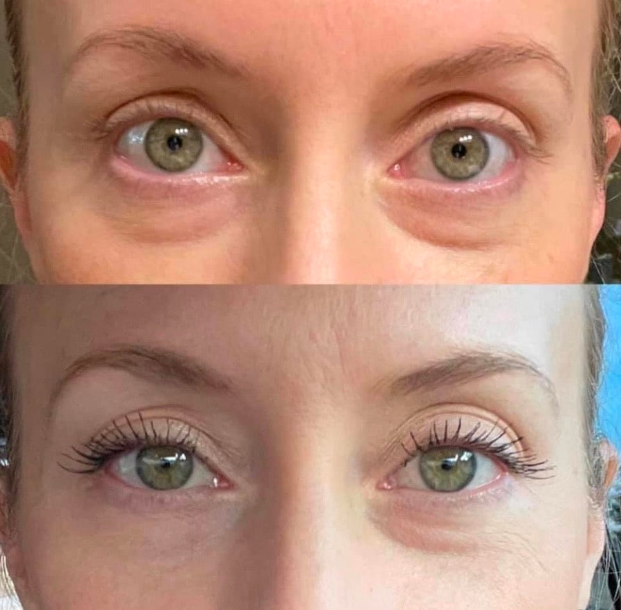 Buskin lumispa sale with eye attachment